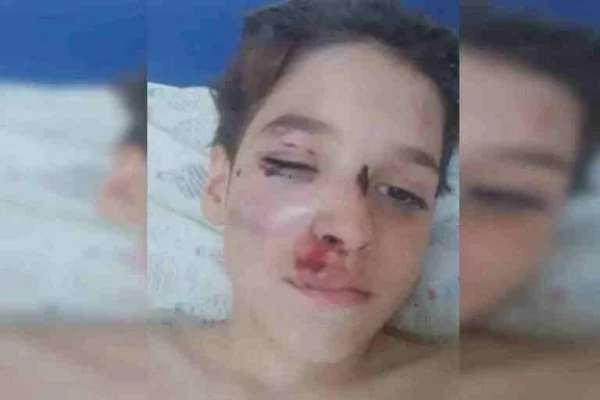 Menino de 9 anos atingido violentamente por ônibus no DF recebe alta