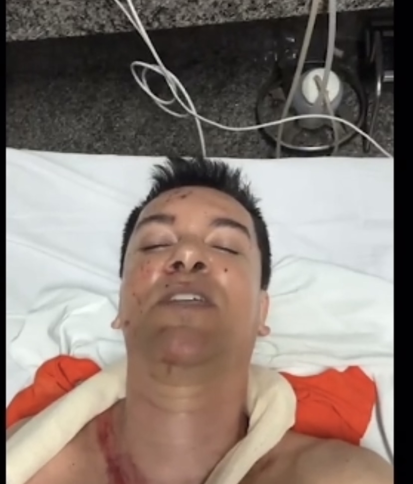 Regis Danese publica vídeo antes de entrar para cirurgia, após acidente na BR-153