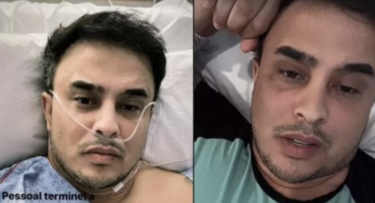 Sertanejo Kauan, dupla de Matheus, passa por cirugia de emergência